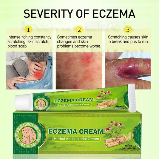 ( 2 Pack)     Sumifun - Eczema Skin Cream